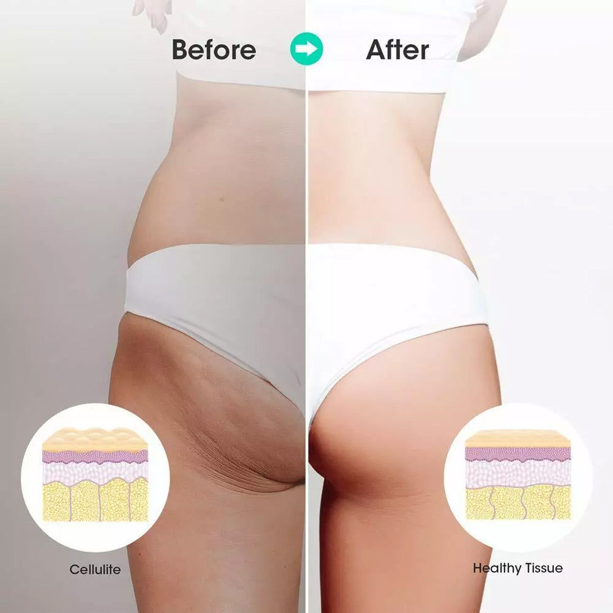 Muscle Roller Stick Full Body Fitness Massage Tool for Home and Gym Use - Yellow