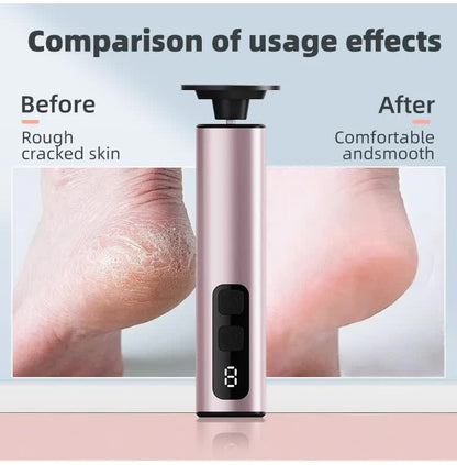 Rose Glod Rechargeable Electric Foot File with 9 Speed Settings - Callus Remover for Smooth Feet
